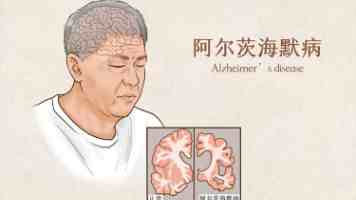 PCB涨停23家，真做AI的不到5个